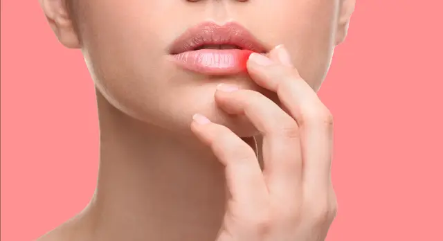 Les bons réflexes face à un bouton de fièvre