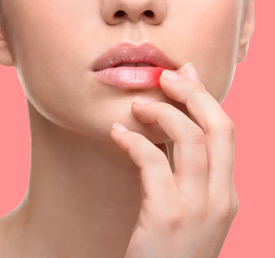 Les bons réflexes face à un bouton de fièvre